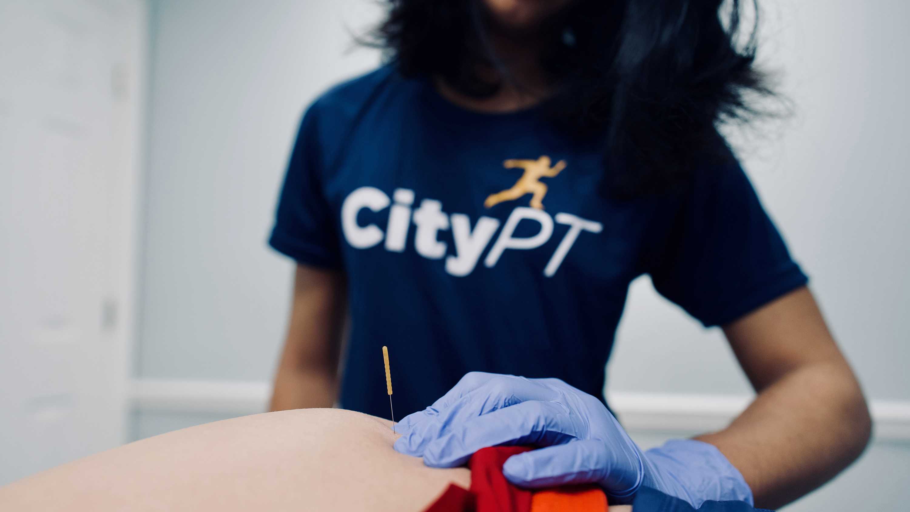 Dry needling treatment in hip