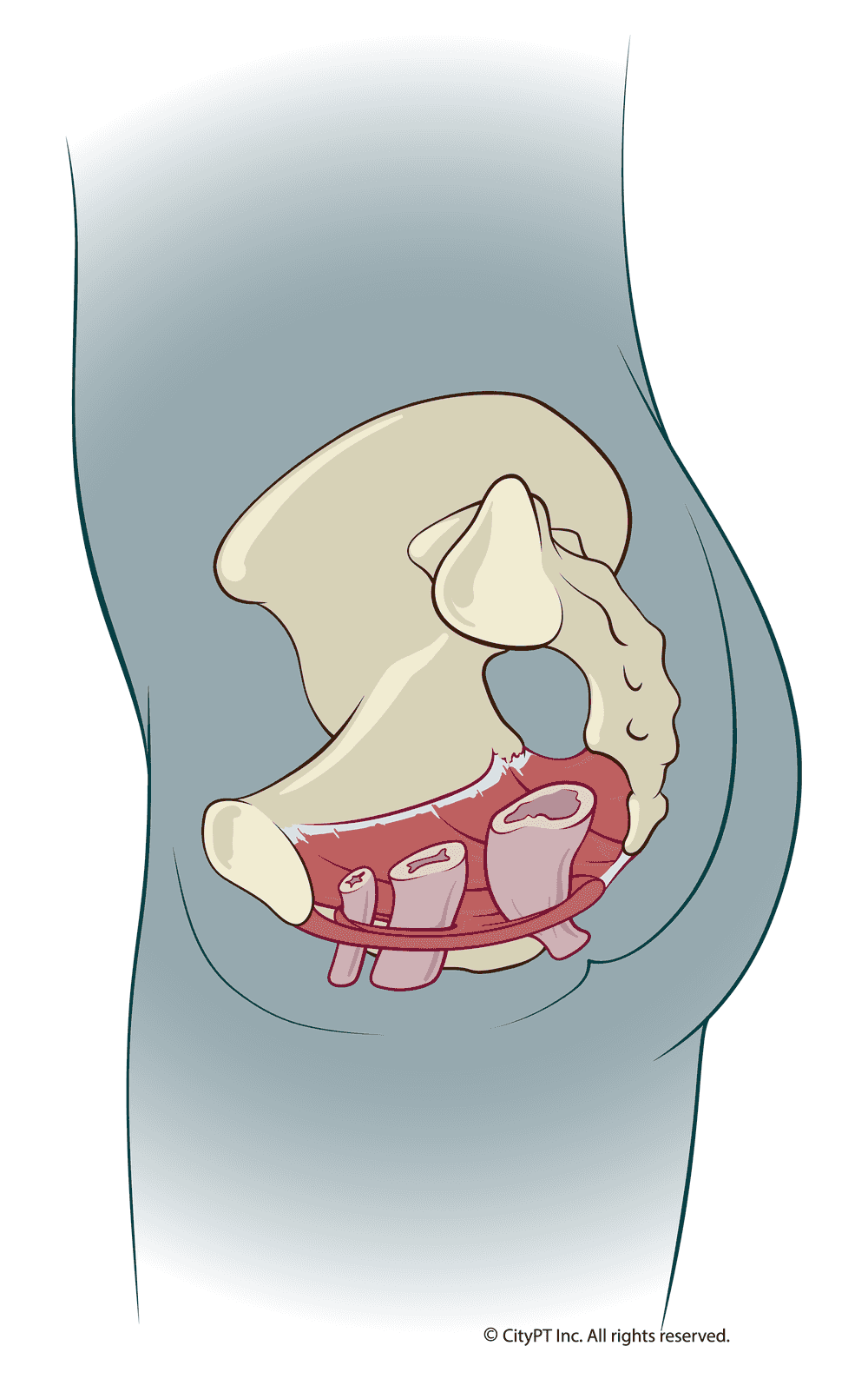 Detailed illustration of pelvic floor dysfunction