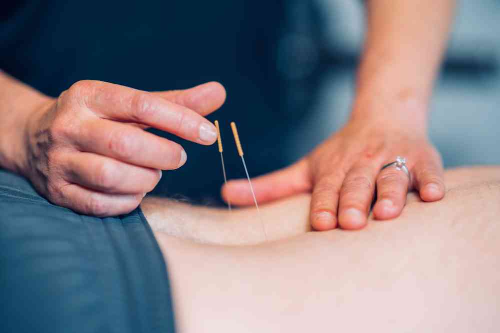 Athlete being treated for back injury with dry needling