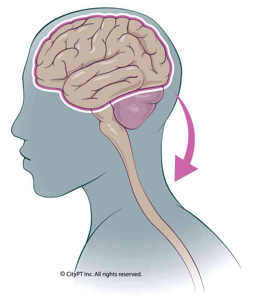 Stress and anxiety can make pain feel more significant, intensifying the experience of neck pain. Illustration of chemicals changes from stress and anxiety leading to physical pain