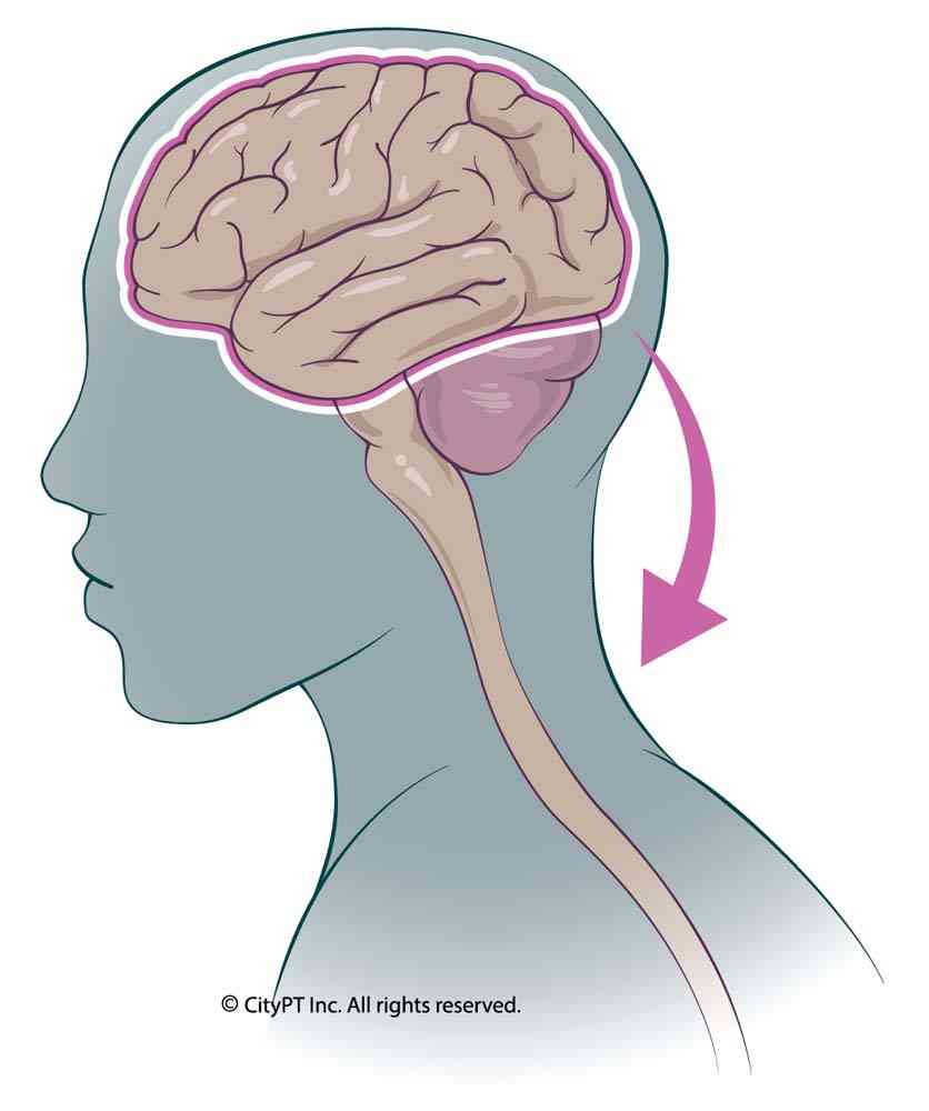 Illustration of chemicals changes from stress and anxiety leading to physical pain