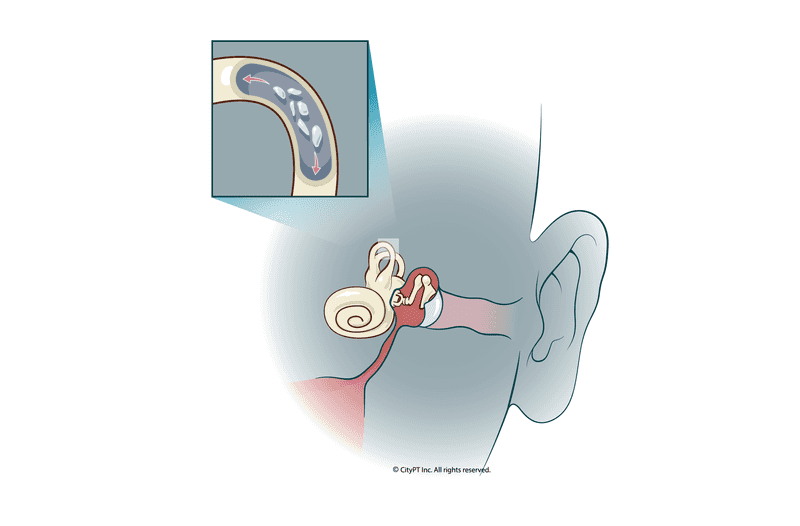 Illustration of vestibular and inner ear anatomy